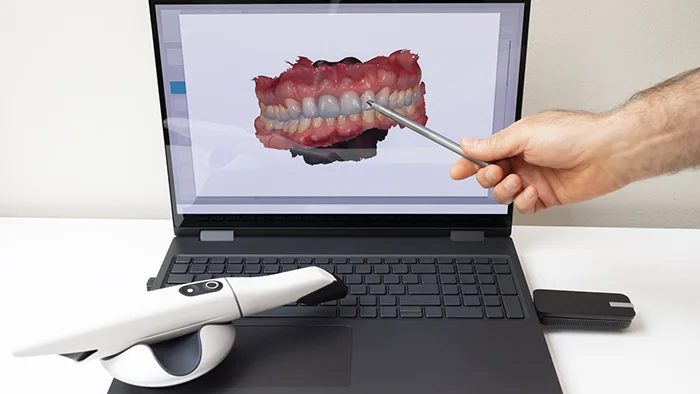 Intra-Oral Scanner & Laptop